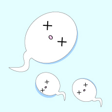 造成精子異常的原因